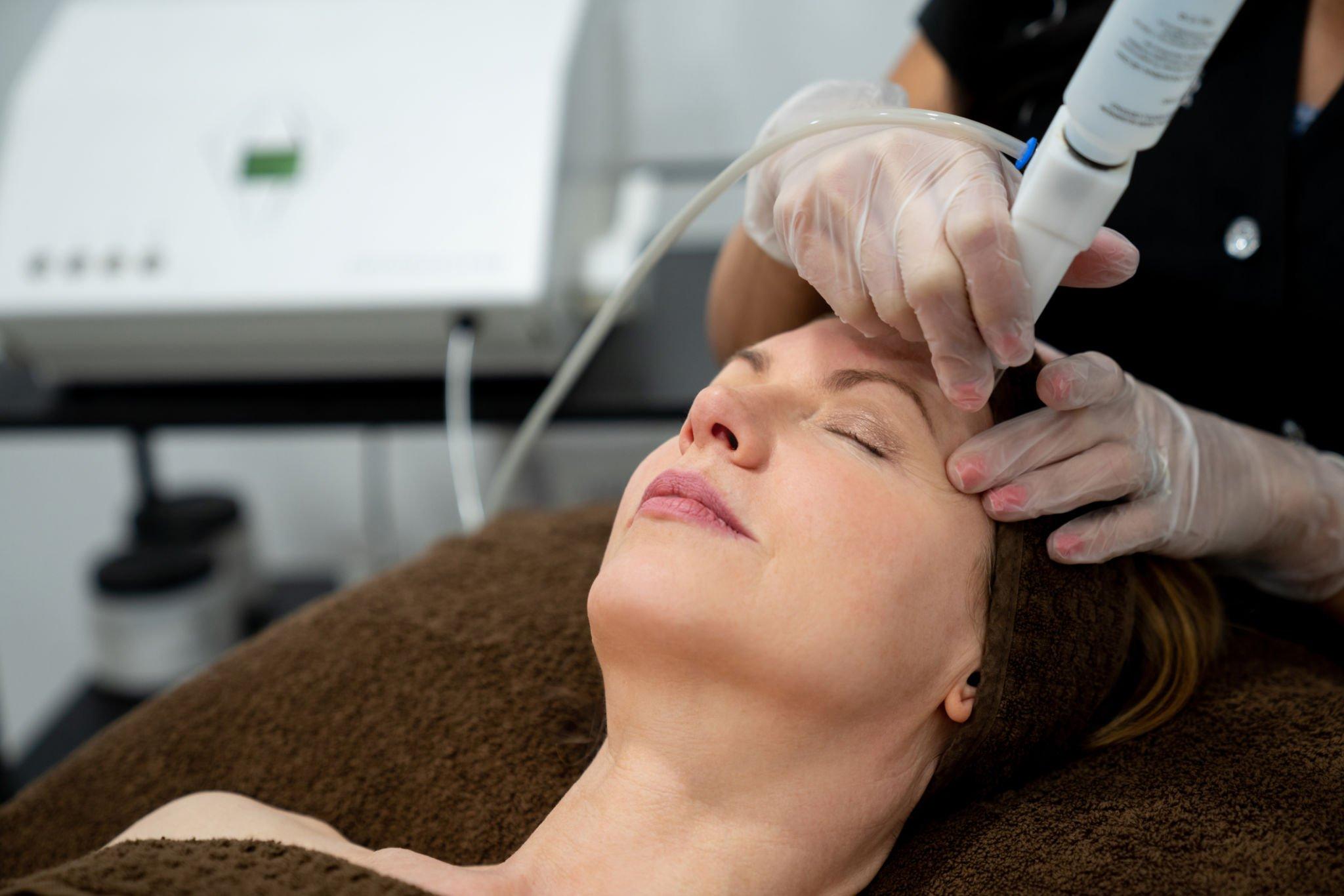 What is skin polishing or microdermabrasion?